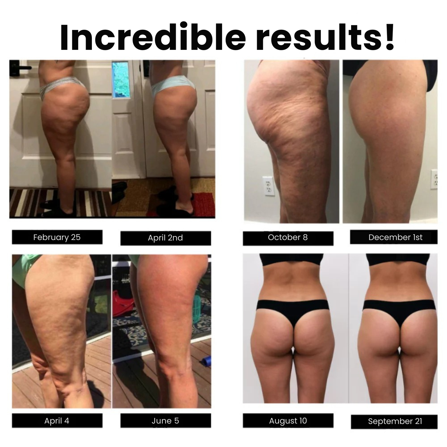 Sleemz™ Anti-Cellulite Leggings